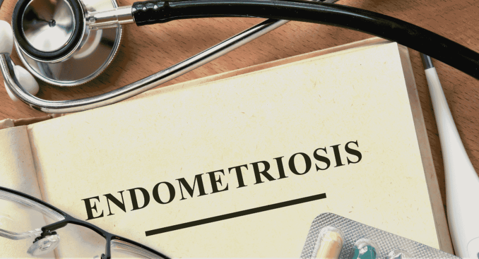 Laparoscopy for Endometriosis