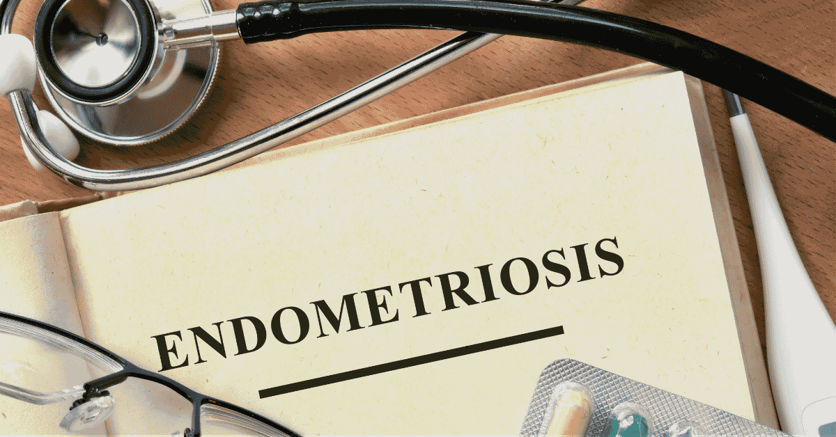 Laparoscopy for Endometriosis