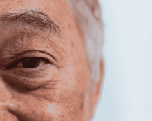 How to Choose the Right Eye Specialist for Cataract Surgery in Singapore