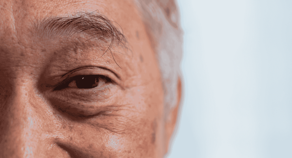 How to Choose the Right Eye Specialist for Cataract Surgery in Singapore