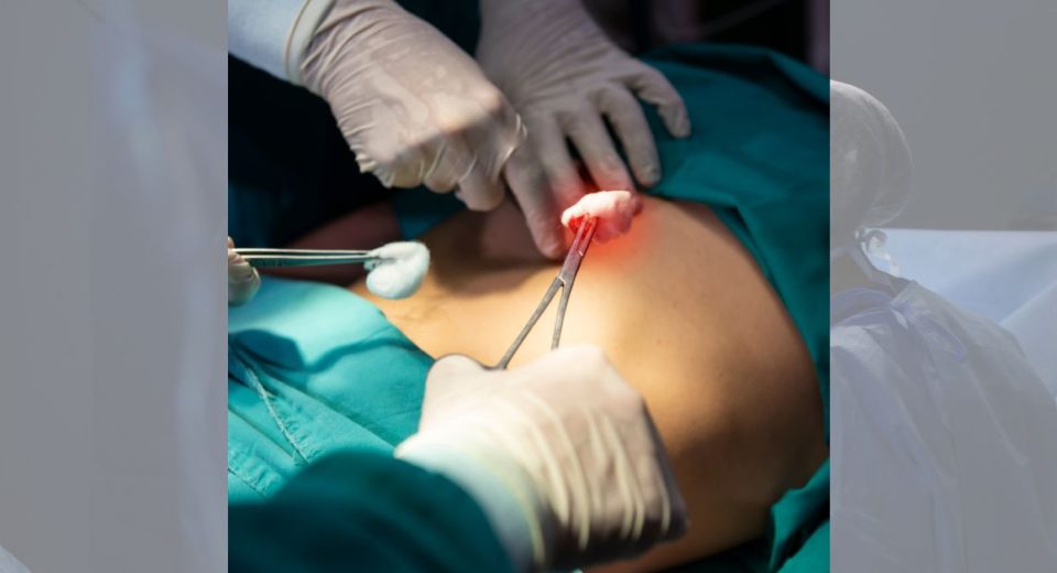 Minimally invasive thoracic surgery