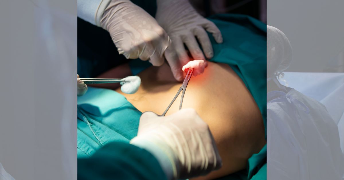 Minimally invasive thoracic surgery