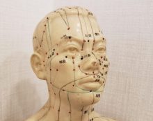 TCM post-stroke rehabilitation