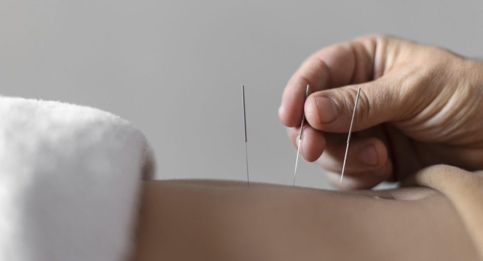 Traditional Chinese Medicine Singapore