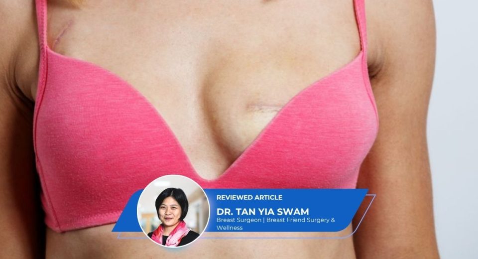 Breast Conserving Surgery