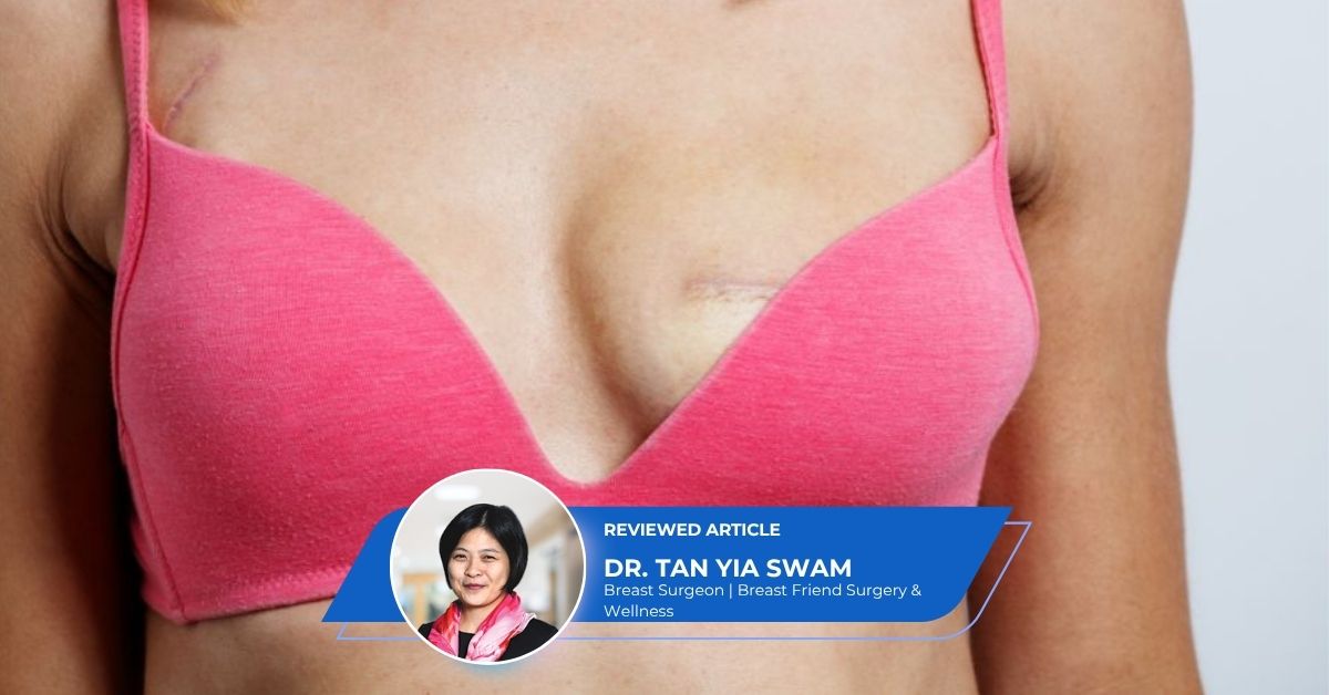 Breast Conserving Surgery
