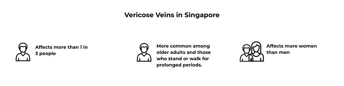 Varicose Veins Infographics