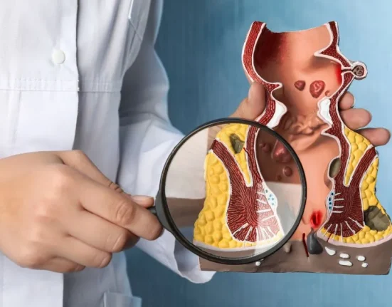 Anorectal Conditions Guide