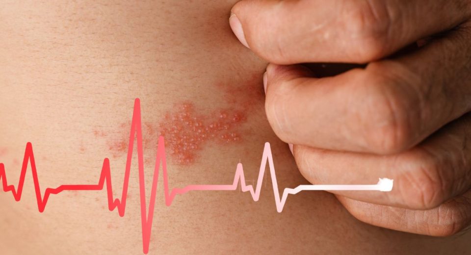 Singles and Heart Attack Risk