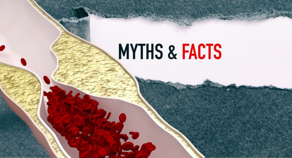 Coronary Artery Disease Myths