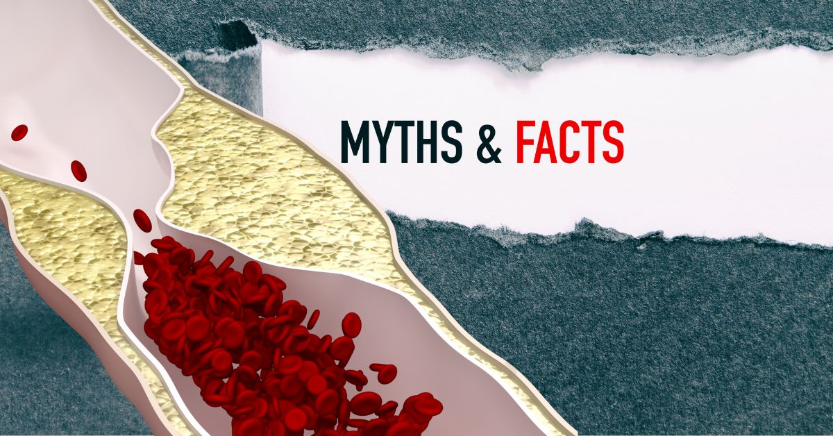 Coronary Artery Disease Myths