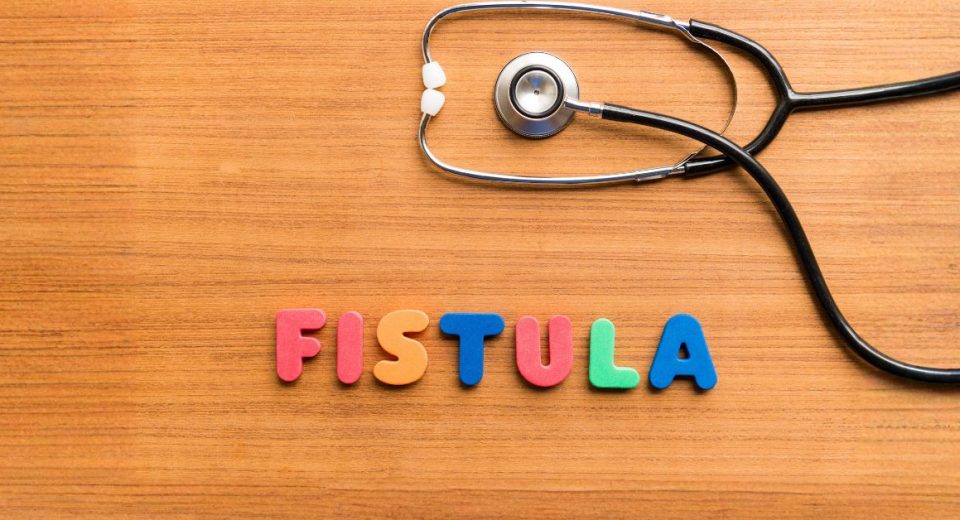 Laser Anal Fistula Surgery