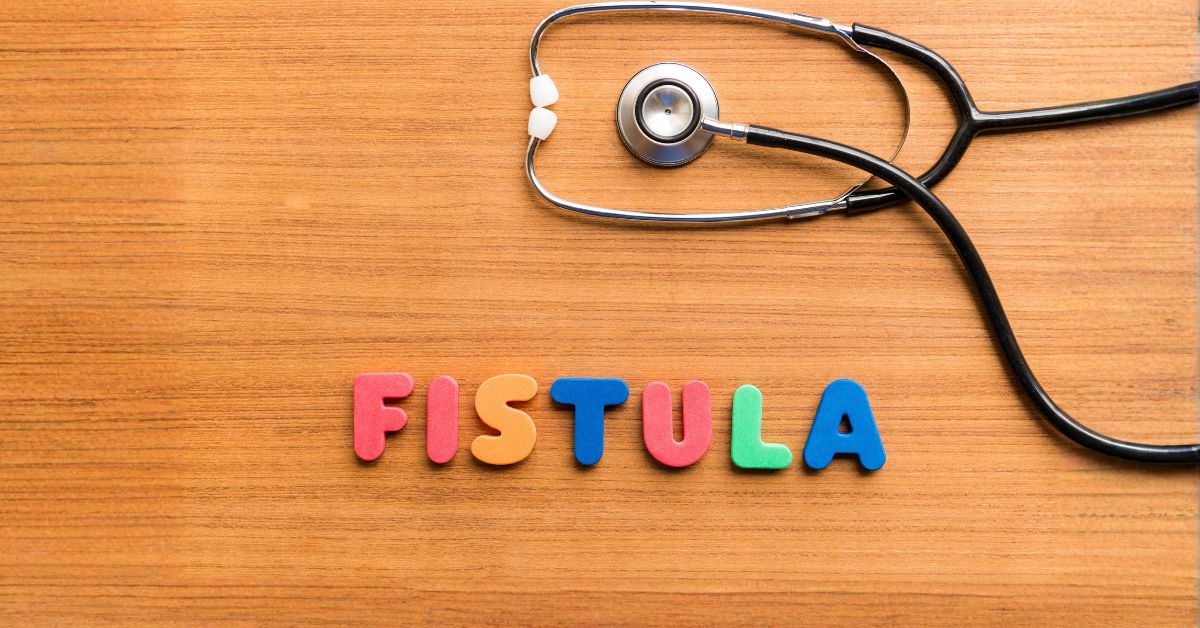 Laser Anal Fistula Surgery