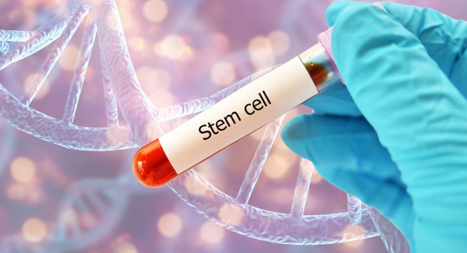 Stem Cell Therapy