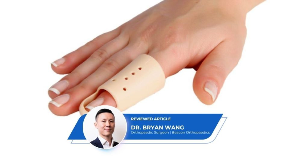Trigger Finger Splint