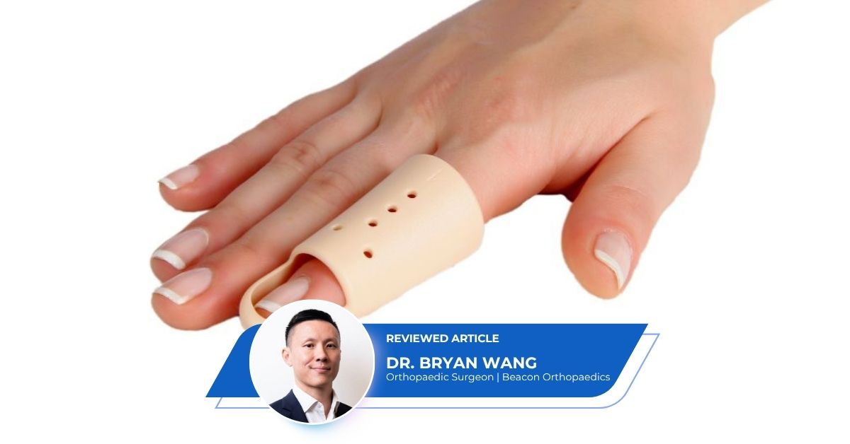 Trigger Finger Splint