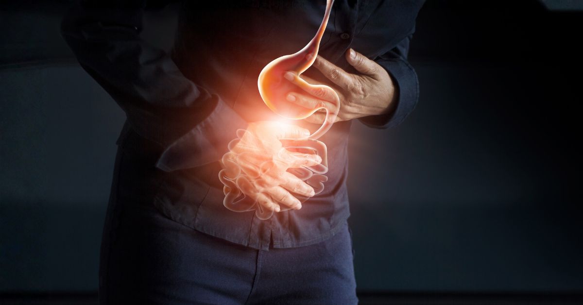 Ulcerative Colitis Vs Crohn’s