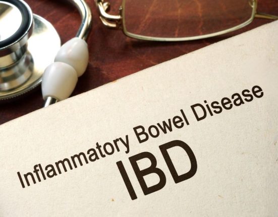 What Is IDB - A Comprehensive Guide