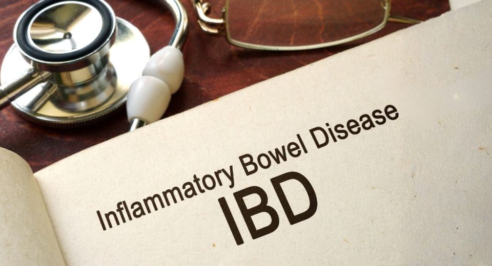 What Is IDB - A Comprehensive Guide