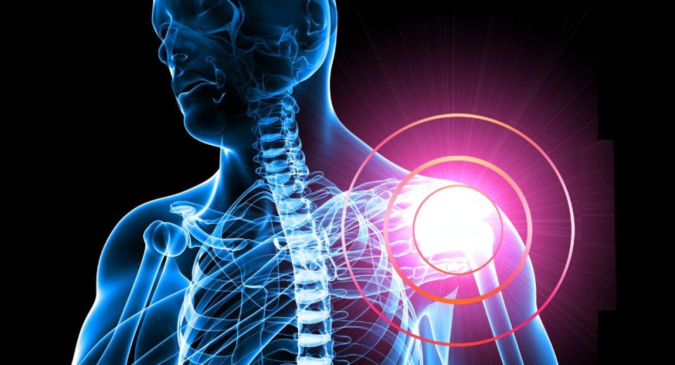 Shoulder Pain