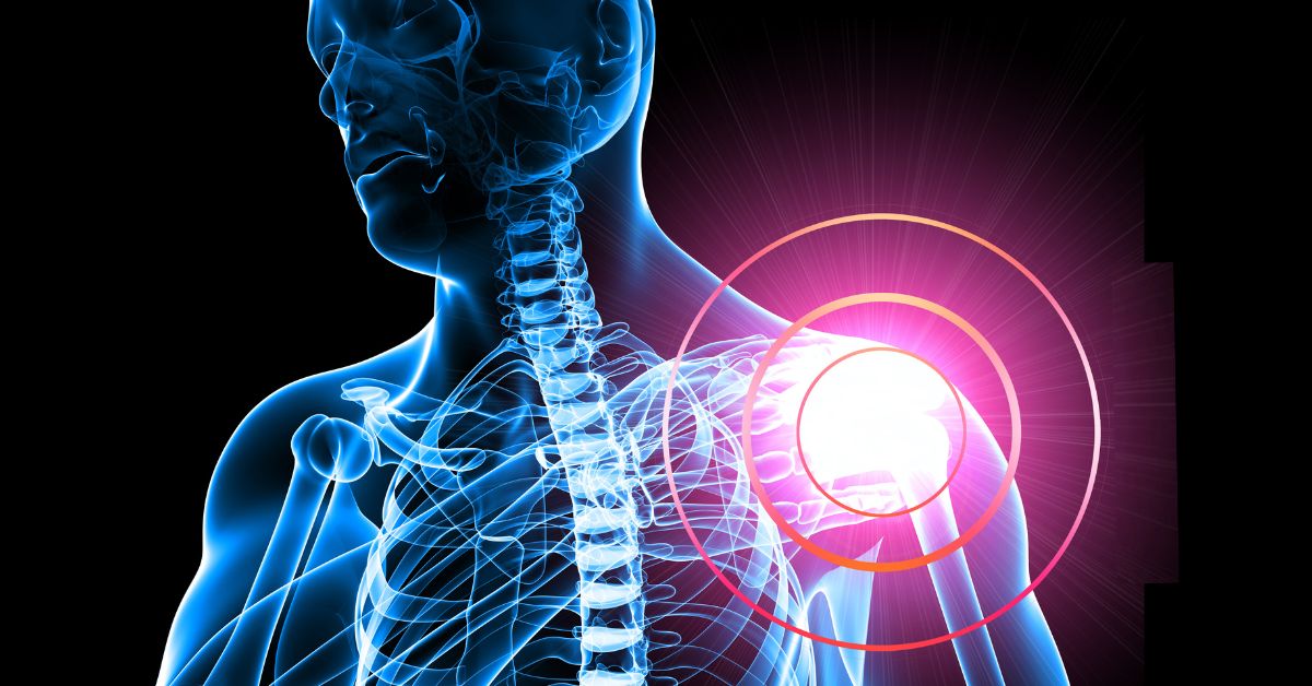 Shoulder Pain