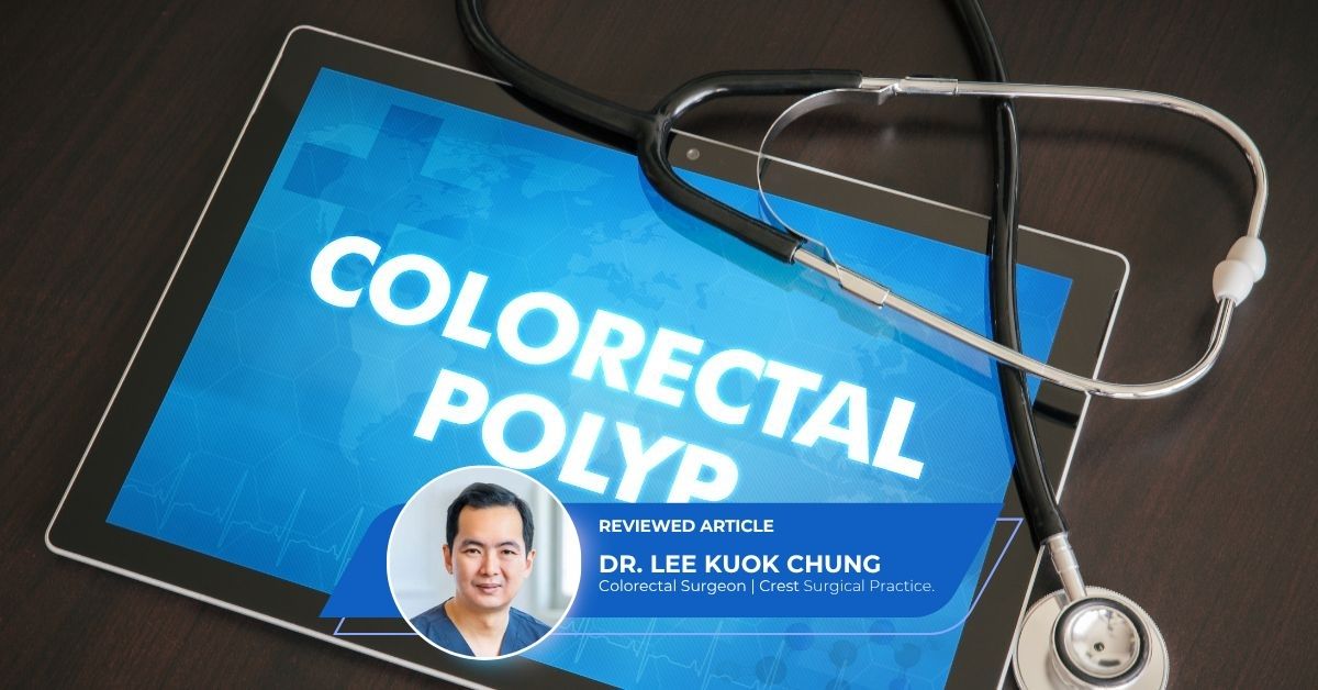 Advanced Endoscopic Polypectomy