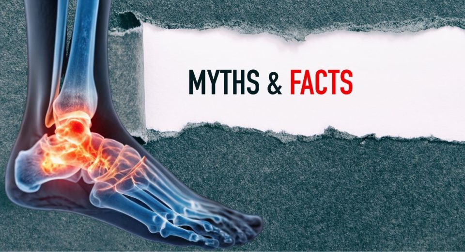 Ankle Arthritis Treatment Myths