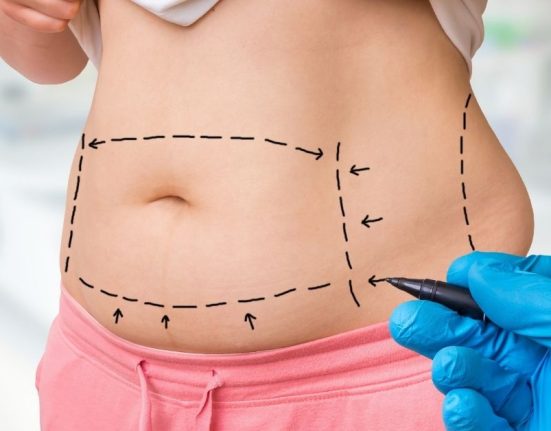 Liposuction Singapore vs Weight Loss Surgery