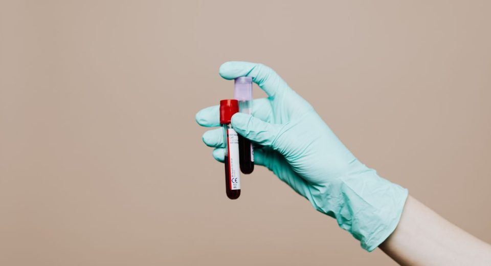 Multi-Cancer Screening