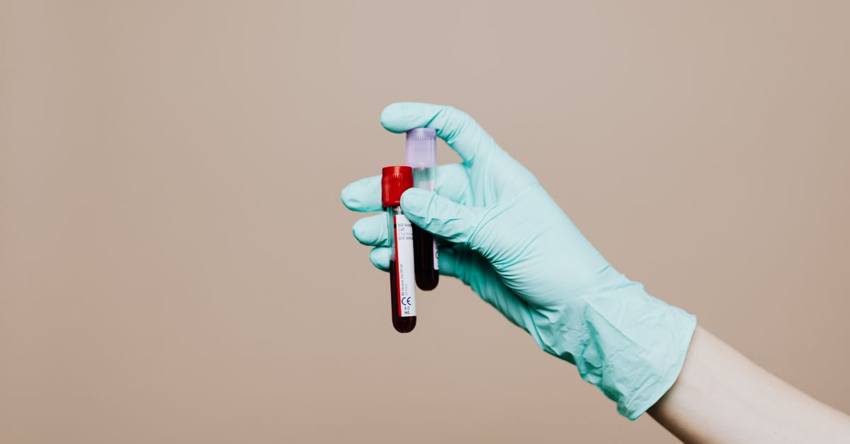 Multi-Cancer Screening