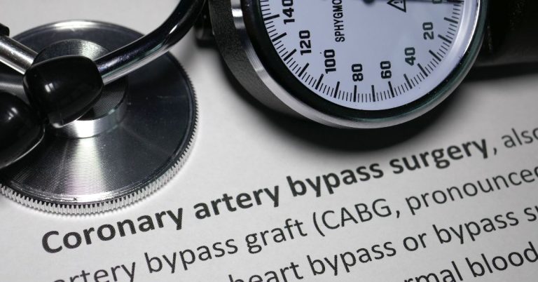 Coronary Artery Bypass Graft Surgery | Comprehensive Guide - Health365
