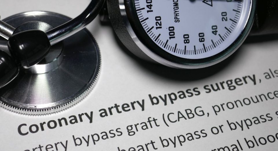 Coronary Artery Disease Bypass Grafting