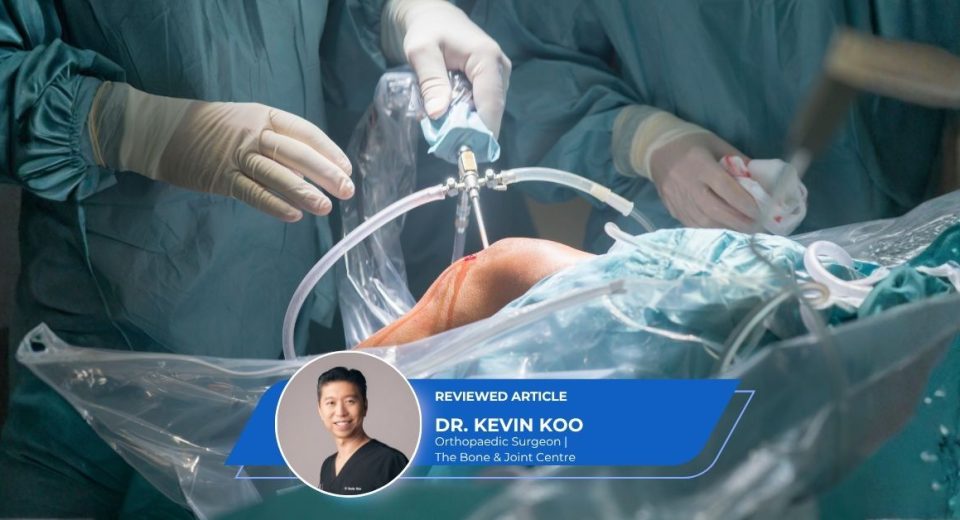 ACL Reconstruction Singapore