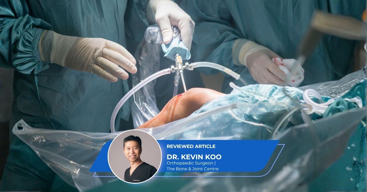 ACL Reconstruction Singapore