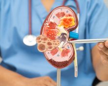 COPD Treatment
