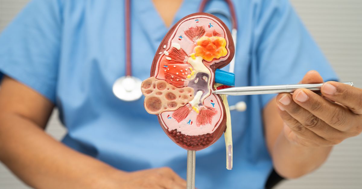 COPD Treatment