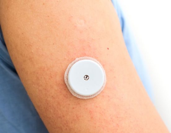 Glucose Monitoring Devices FAQ