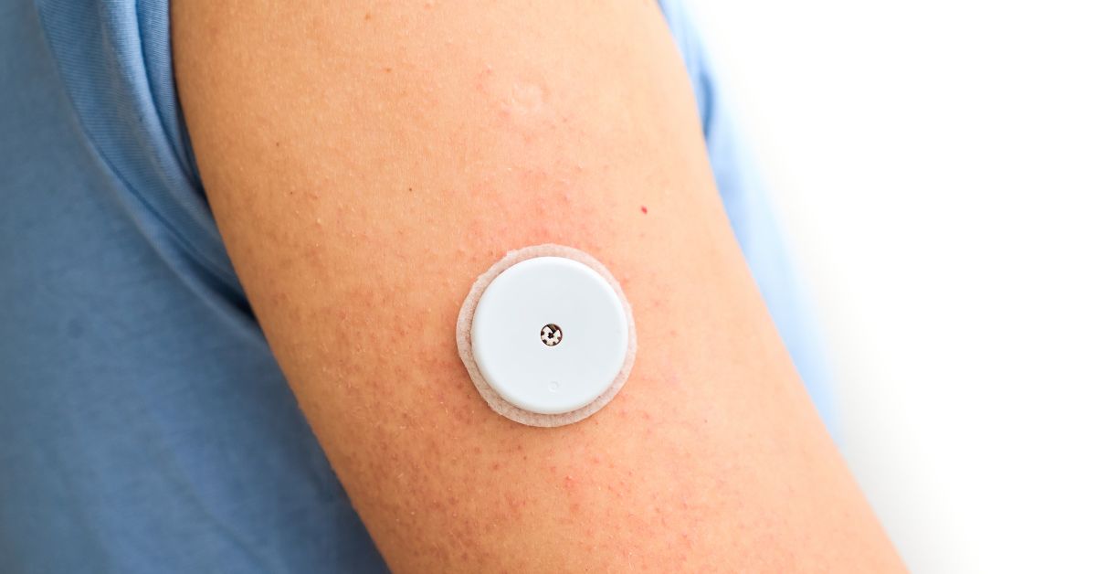 Glucose Monitoring Devices FAQ