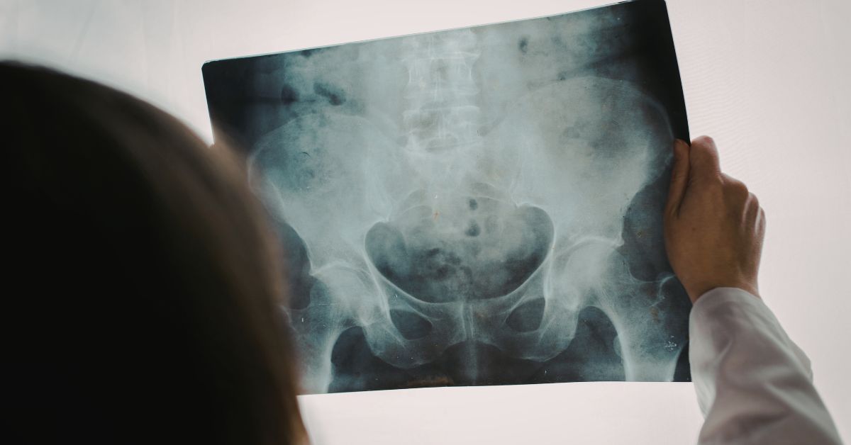 Chronic Pelvic Pain Management Specialist