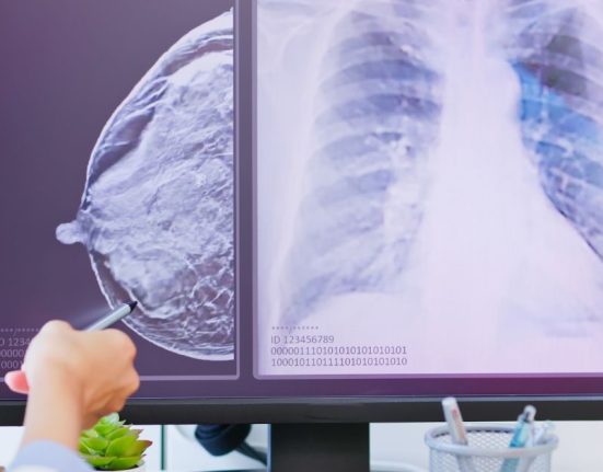 Breast Cancer Surgery in Johor