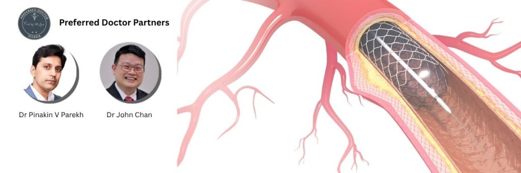 Coronary Artery Disease Key Visual v3