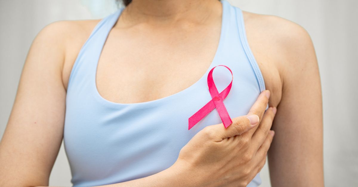 Oncoplastic Breast Surgery