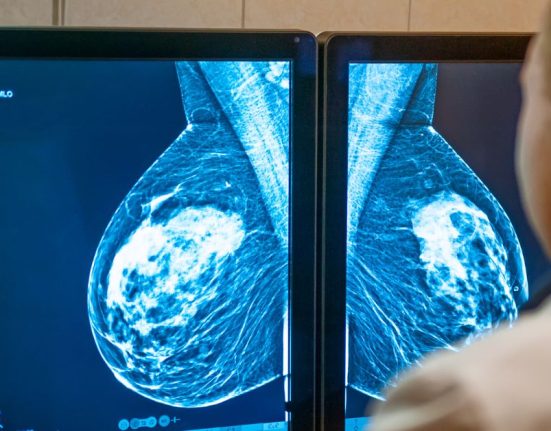 Suspicious Mammogram Result