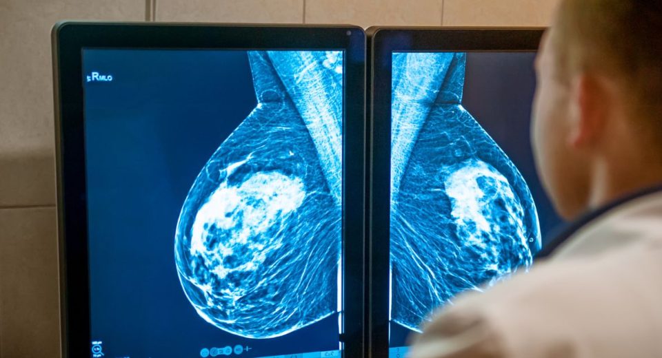 Suspicious Mammogram Result