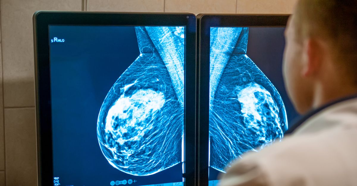 Suspicious Mammogram Result
