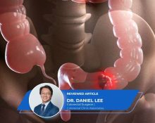 TAMIS Keyhole Surgery