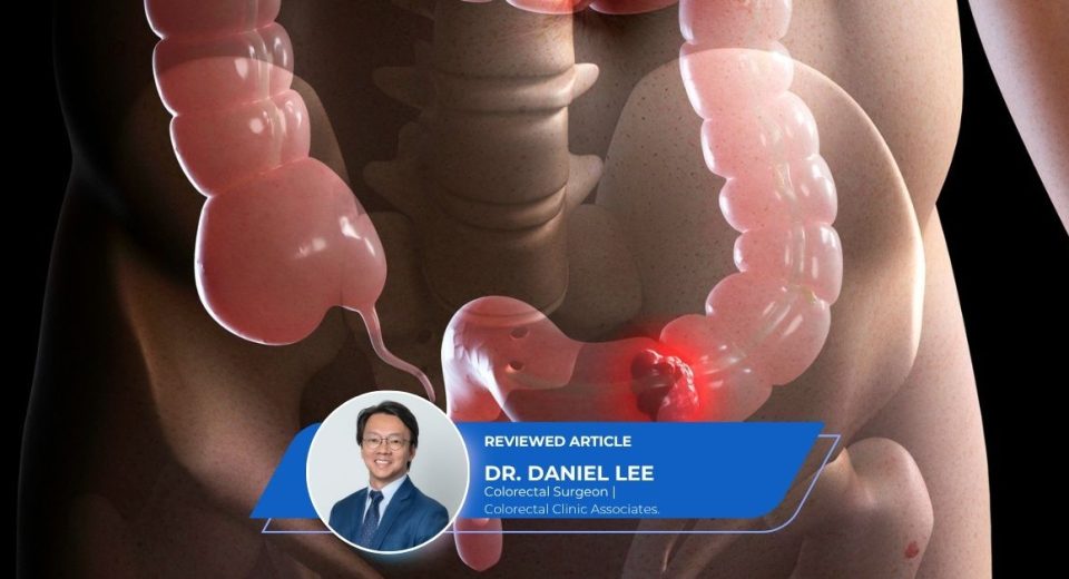 TAMIS Keyhole Surgery