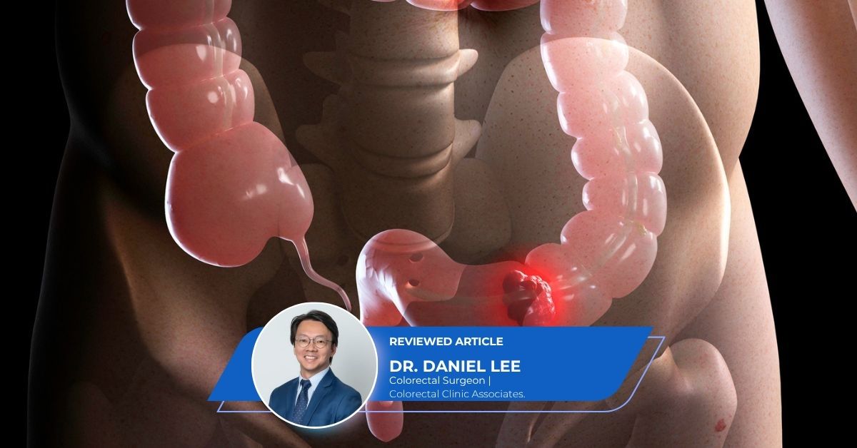 TAMIS Keyhole Surgery