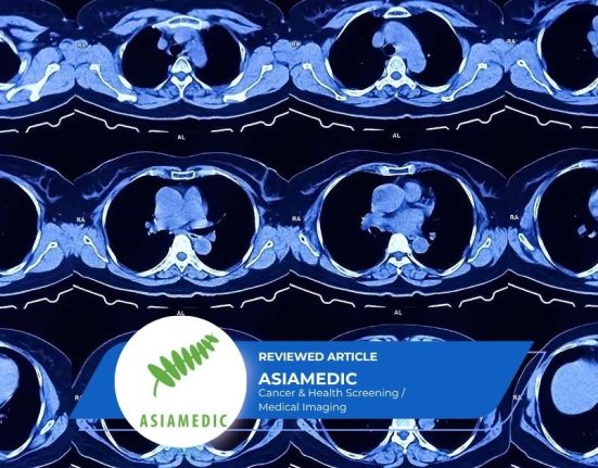 64 Slice CT scan is it sufficient