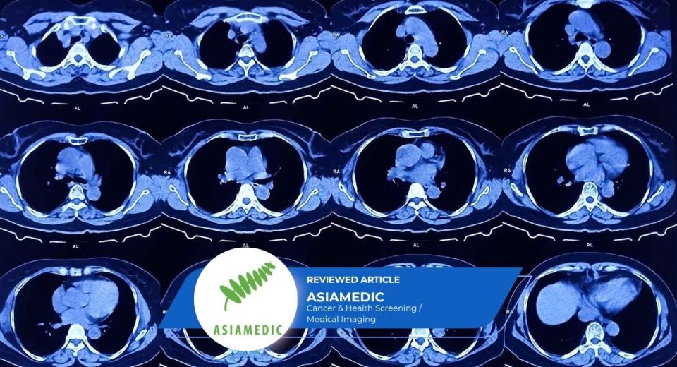 64 Slice CT scan is it sufficient